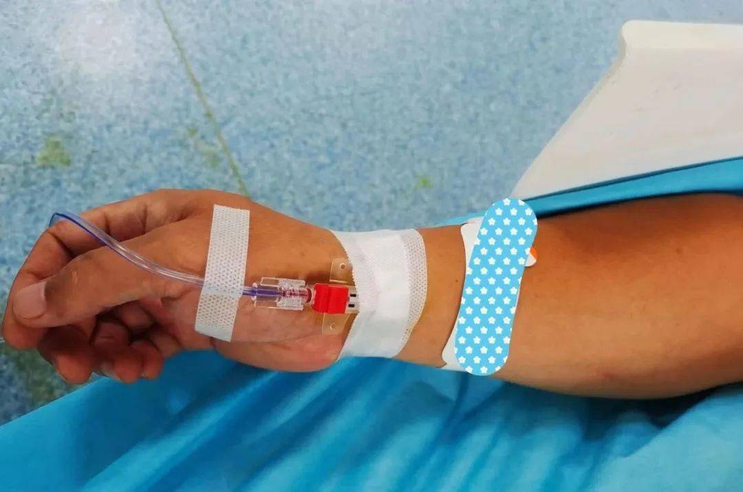 实用技术 | 超声引导下桡动脉穿刺置管术_压迫_麻醉_患者