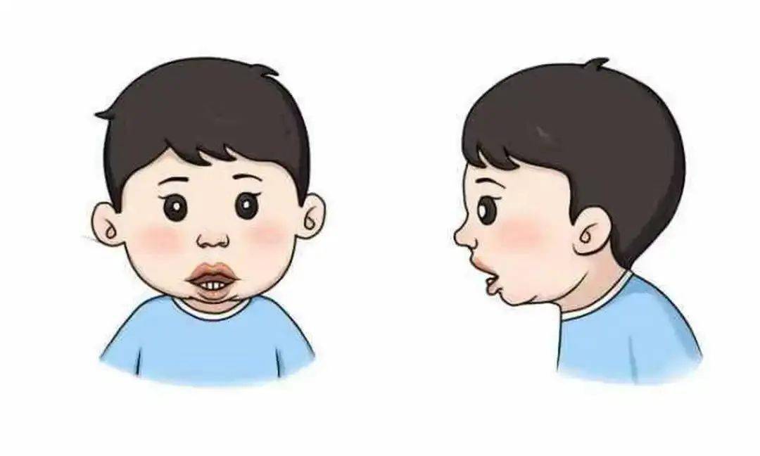 【市中医 | 科普周】科普新秀话健康3:家有"呼噜娃",警惕腺样体肥大