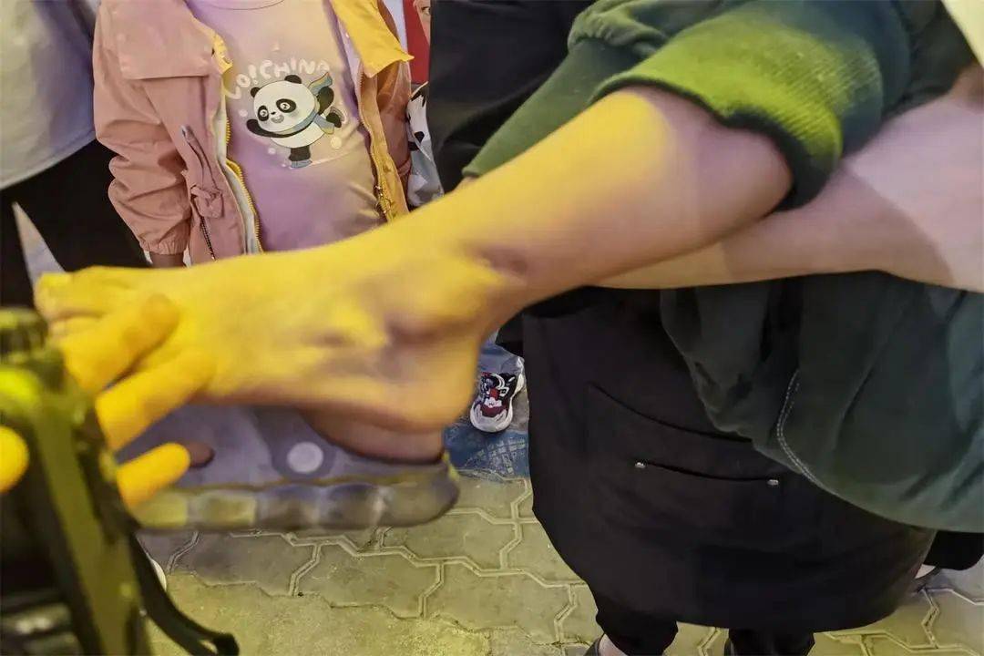 小孩脚卡自行车 银川消防开展紧急救援_进行_脚踝_男孩