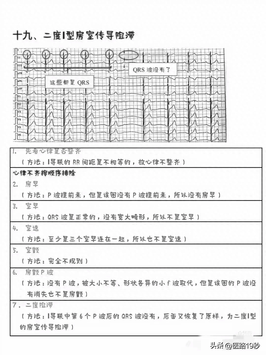 心律不齐报告单图片