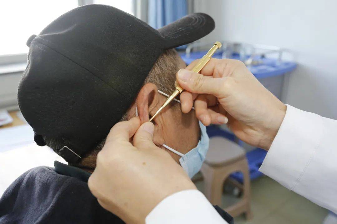 东营市中医院邀您来体验耳穴贴压技术