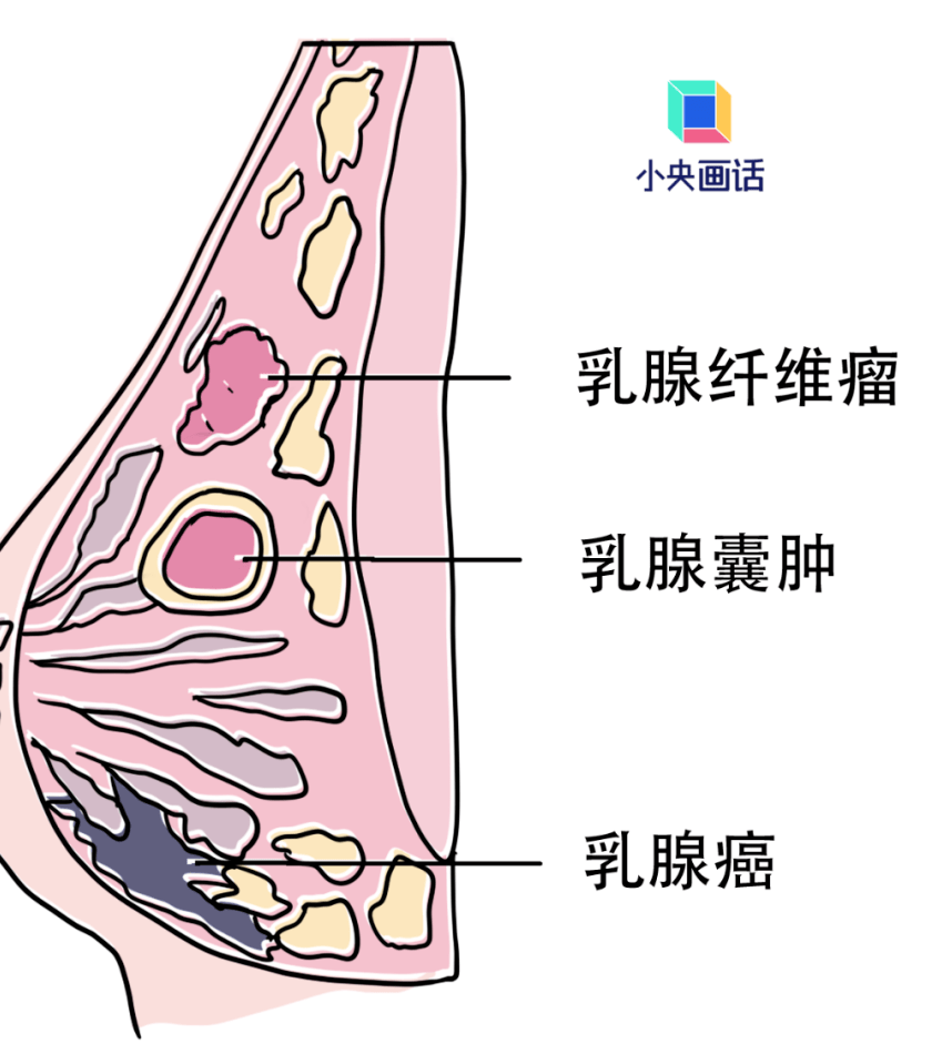 学会自检