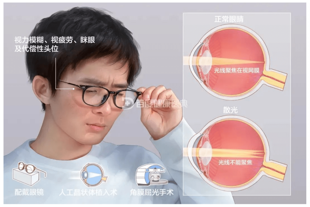 一分钟测出自己是不是散光_江苏省_治疗_康复