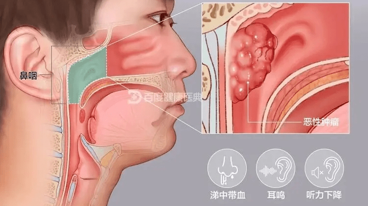 疾病科普 | 喉咙不舒服,这些喉部检查方法,你一定要看!
