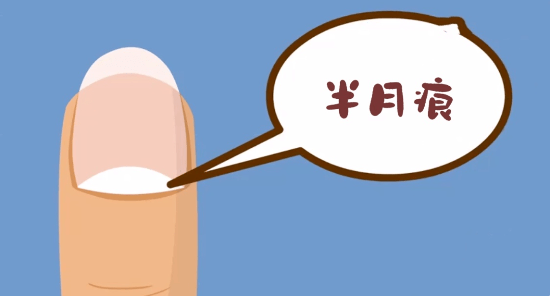 月牙能反映健康状况?真相是…_半月_细胞_手指