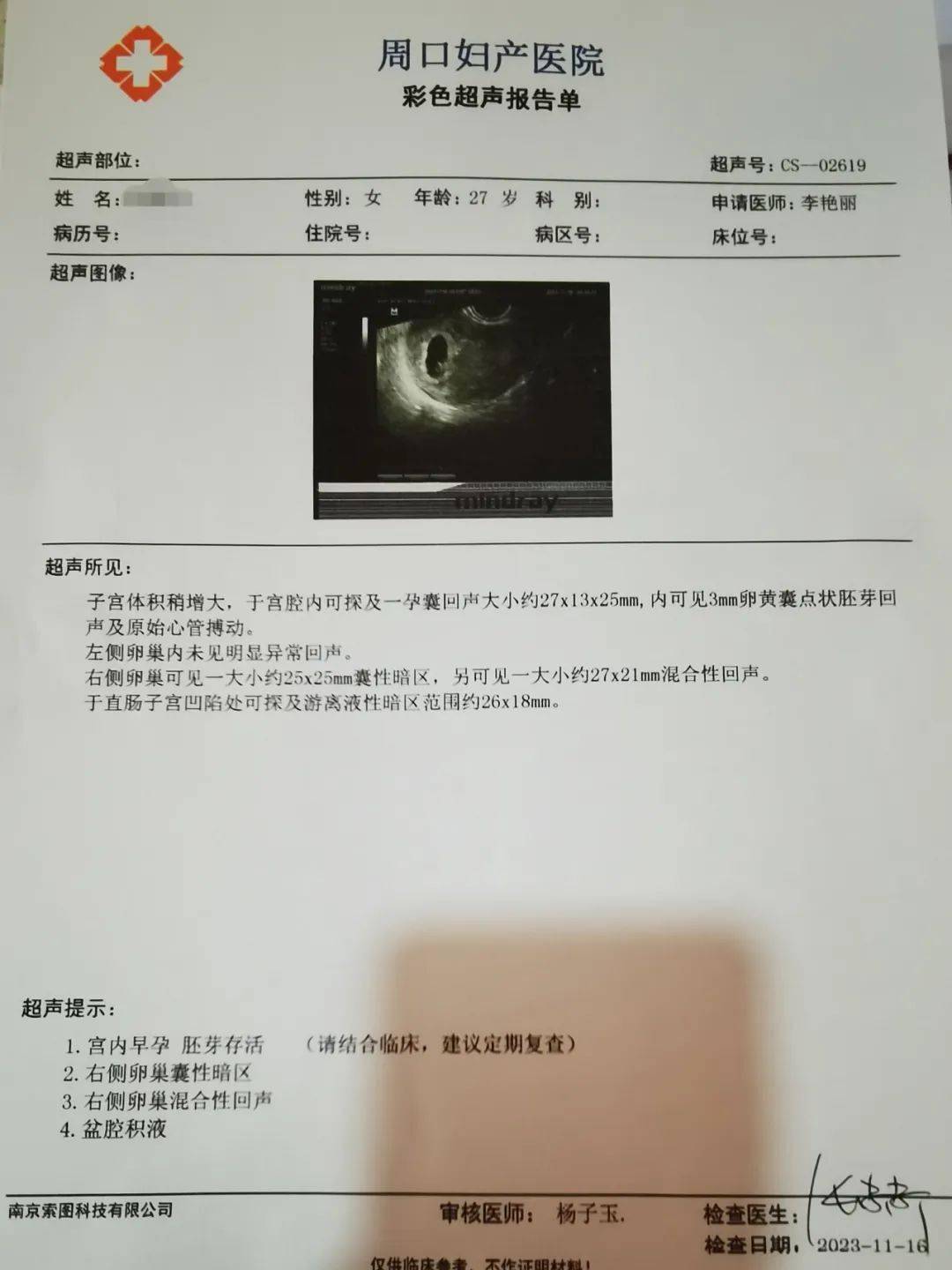 葡萄胎之后遭遇不孕,在我院实现好孕梦想!_治疗_周口_曹女士