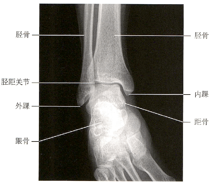足踝关节解剖丨骨骼,关节,软组织_韧带_白箭_显示