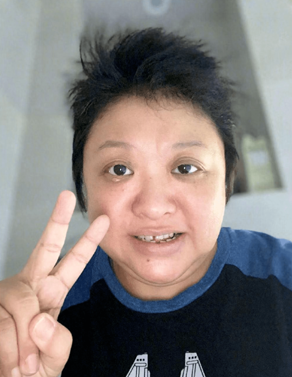 韩红现身暴瘦引担忧,缺多颗牙齿眼睛肿胀,低调戴廉价手表变化大_减肥