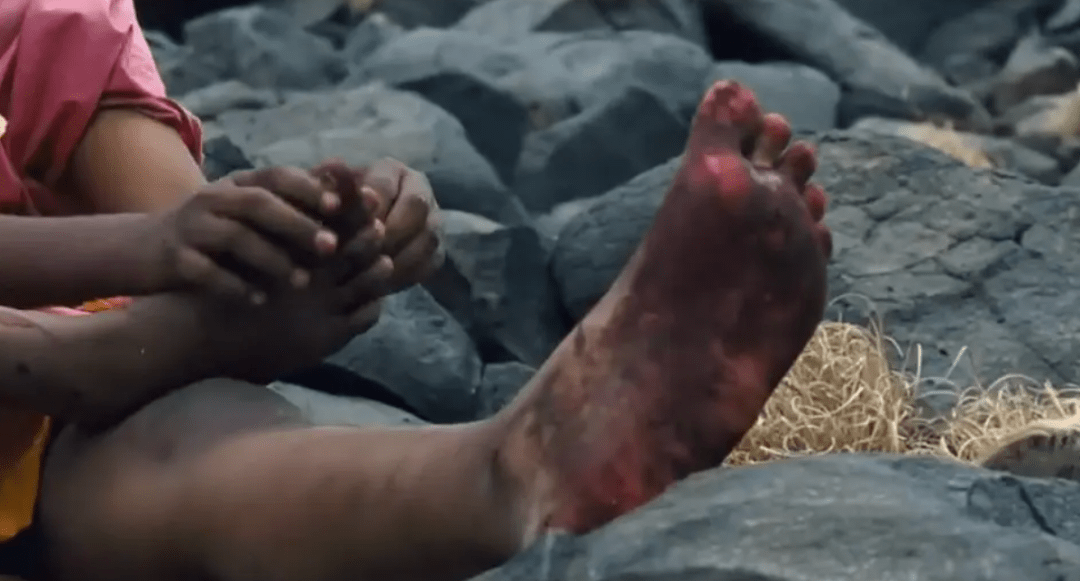 吴亦凡二审出结果,她仍在水深火热_女孩_伤口_因为