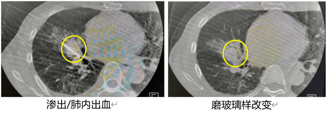 艾聯合,新標