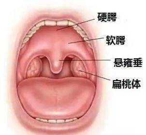 咽喉小舌头肿大图片图片