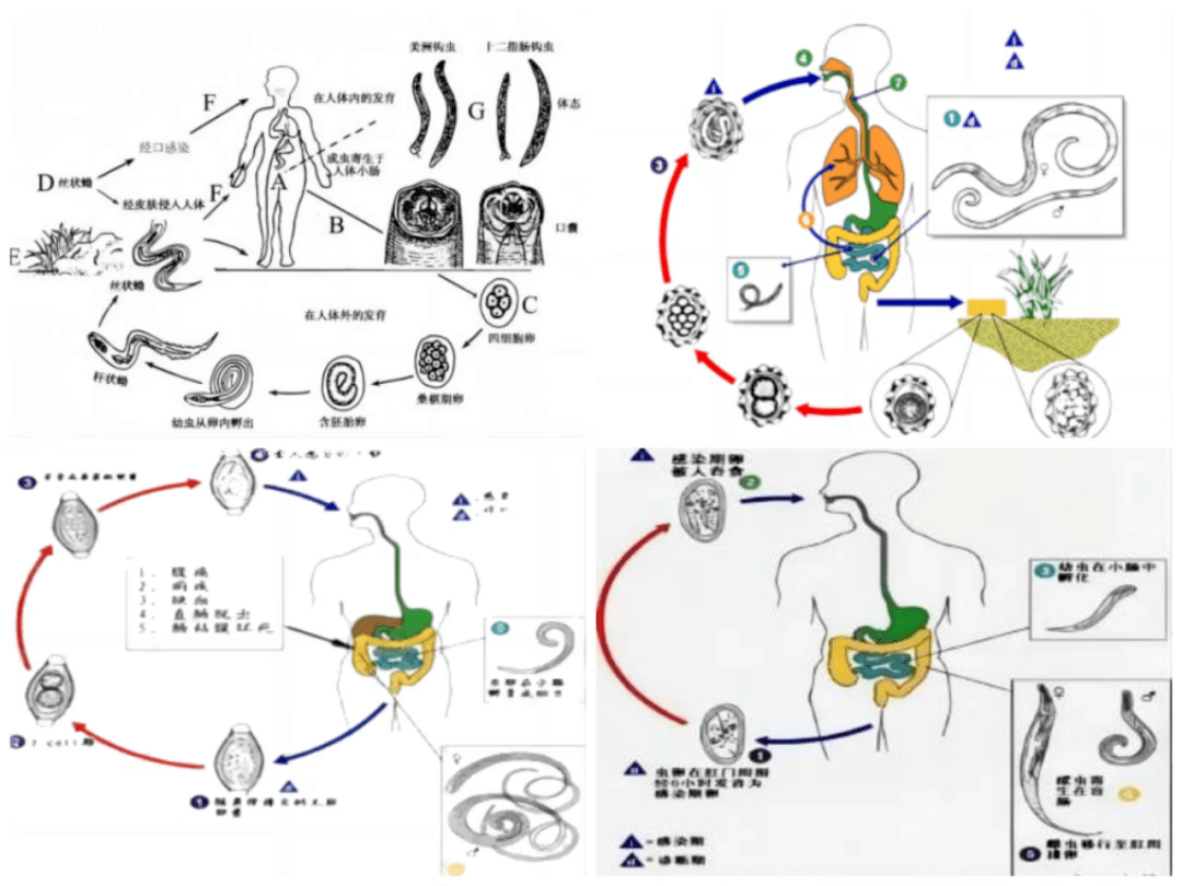 蛲虫病和蛔虫图片