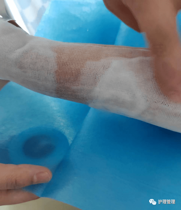护士长再次向夜班护士了解具体过程,遵医嘱使用25%硫酸镁间断冷湿敷
