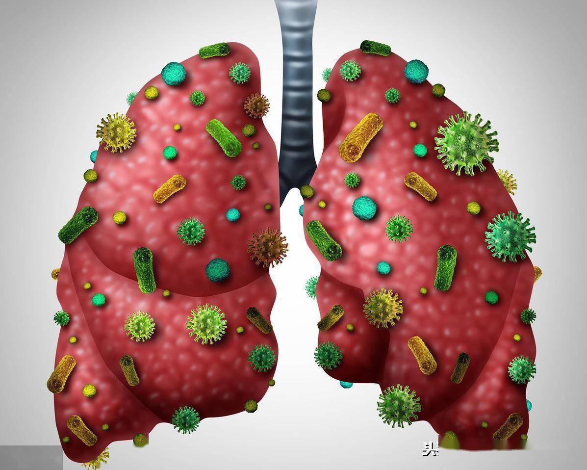 身体出现6个"怪样",基本可以断定:你得肺炎了_患者_症状_细菌