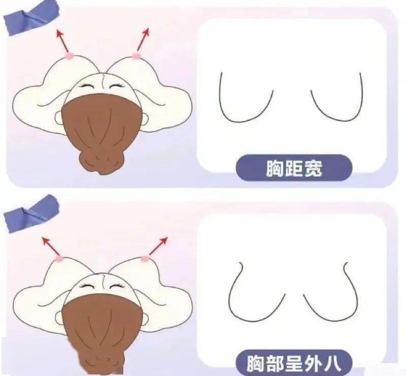 70% 的胸型外扩是后天导致的但容易外扩,经调查显示大多数一体式內衣