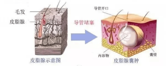 下面就帶大家認識幾種常見的外陰