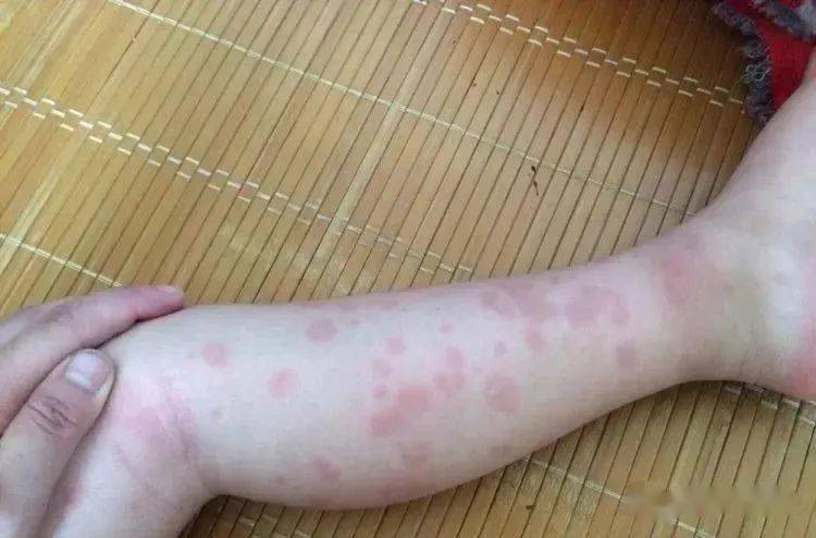 宝宝辅食的黄金时期——营养与美味并重的选择