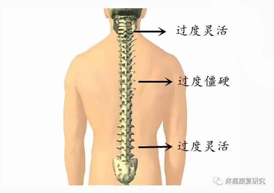 頸痛不可忽視的原因:胸椎活動度_關節_頸椎_腰椎